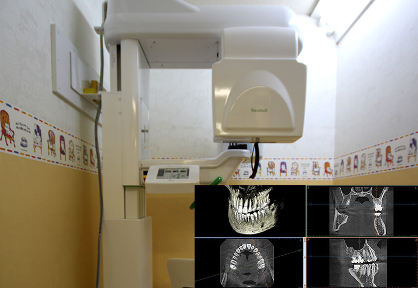 3D画像で正確な診断・精密な治療を行うための「歯科用CT」